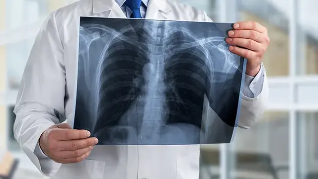 5 Tips Memahami Ilmu Radiologi Dasar